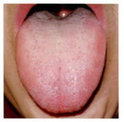正常舌
